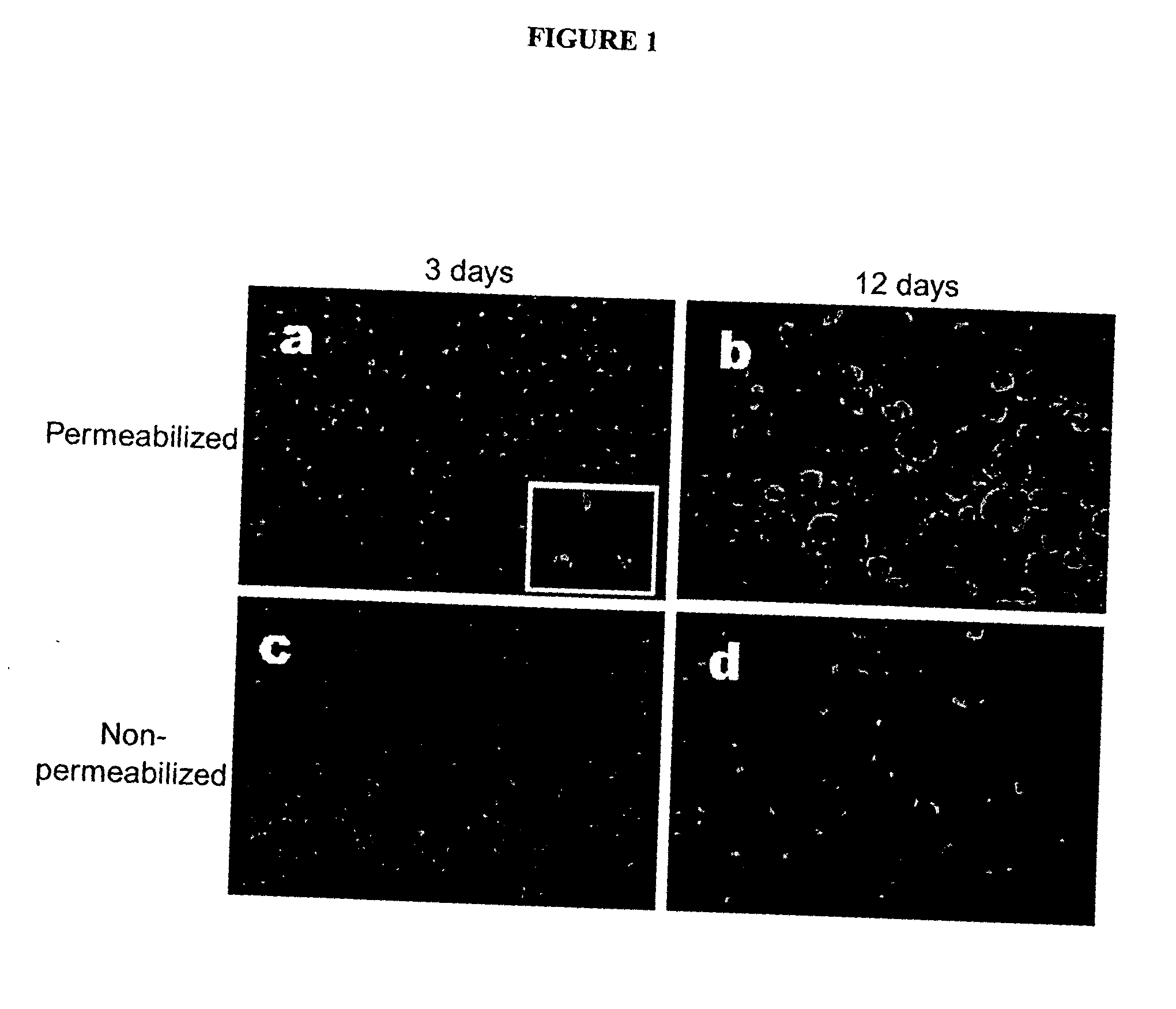 Methods of secretory vimentin detection and modulation