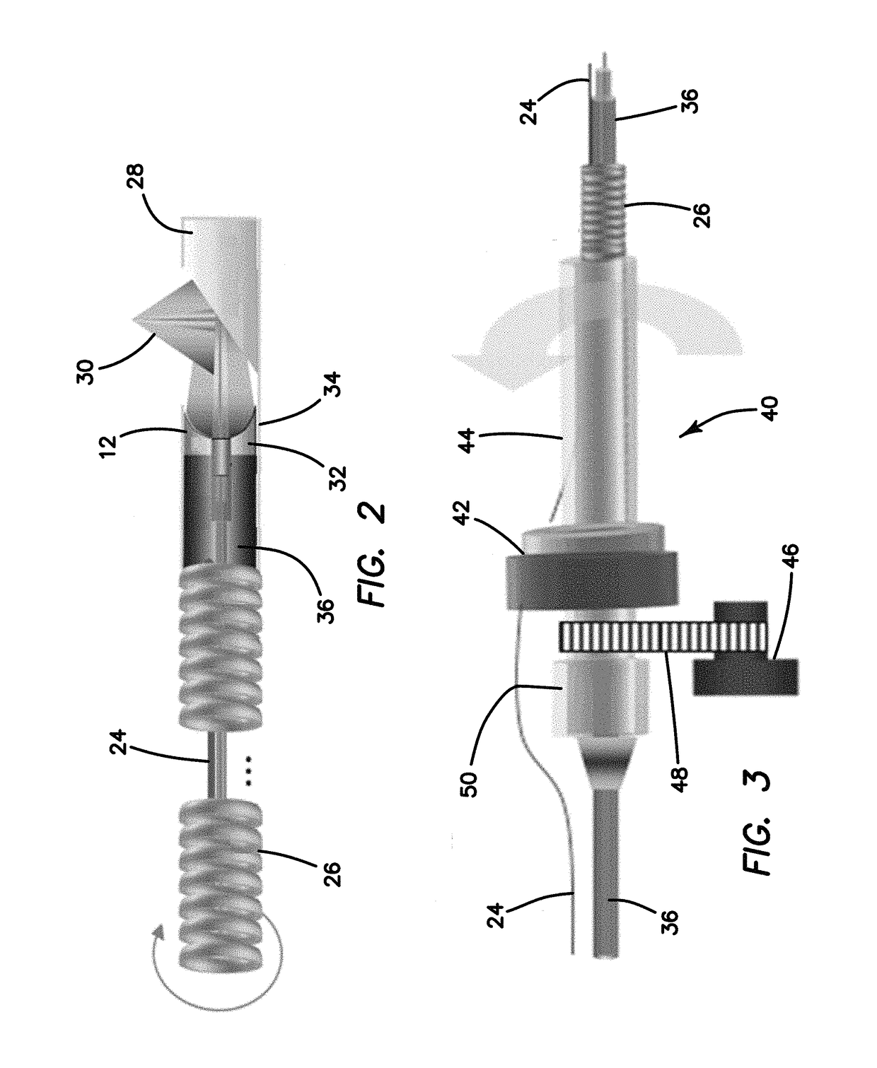 Integrated multimodality intravascular imaging system that combines optical coherence tomography, ultrasound imaging, and acoustic radiation force optical coherence elastography