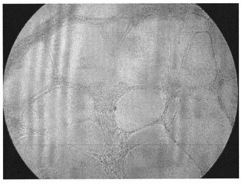 Method for largely expanding late endothelial progenitor cells from peripheral blood