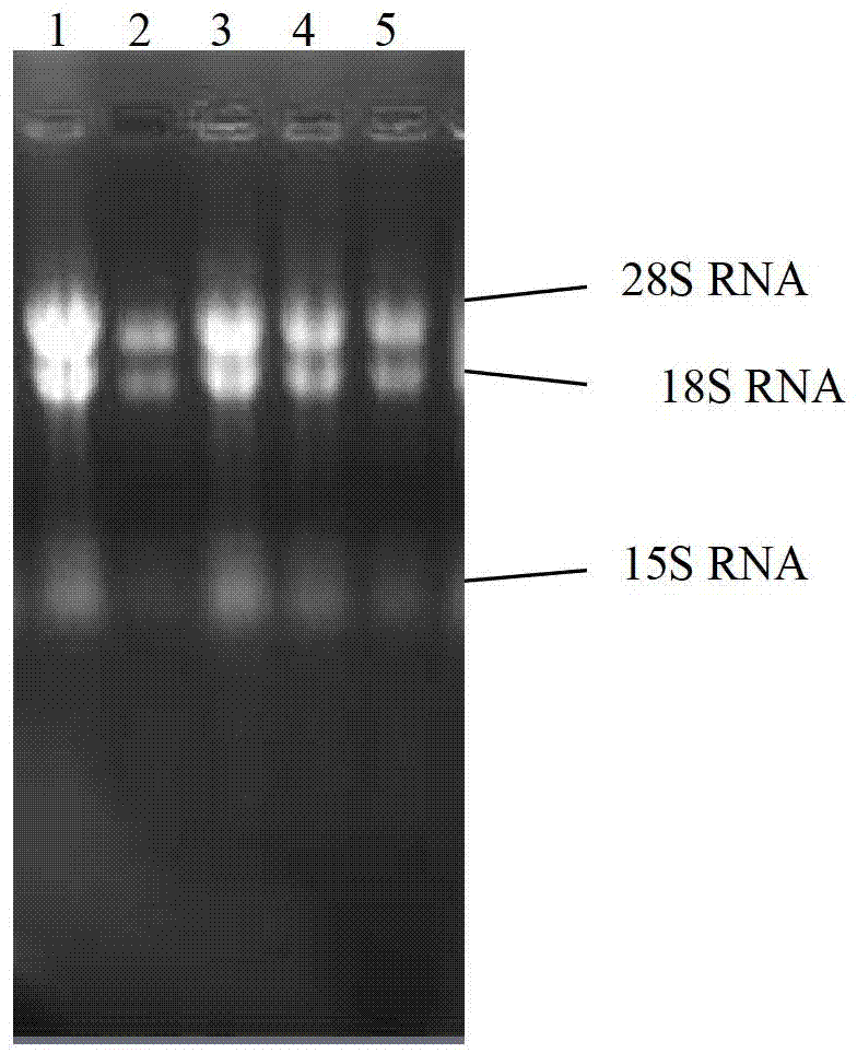 Enzyme of cordyceps sinensis hirsutella sinensis anabolic adenylic acid, gene and application of enzyme