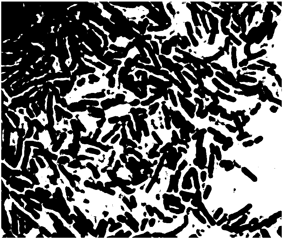 Lactobacillus casei lactobacillus casei strain Qian working starter product and its therapeutic use for intestinal regulation