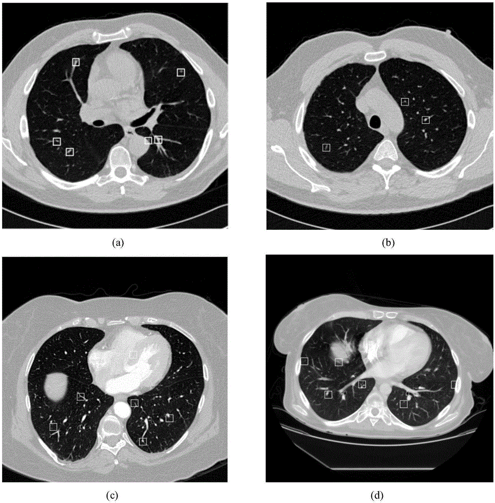 Lung tubercle automatic detection method based on 3D convolutional neural network