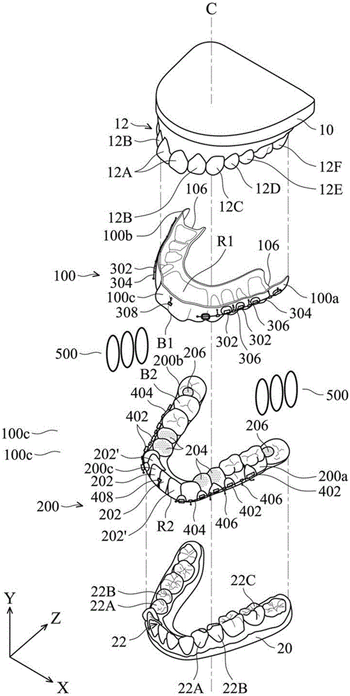 Tooth jaw orthotic device