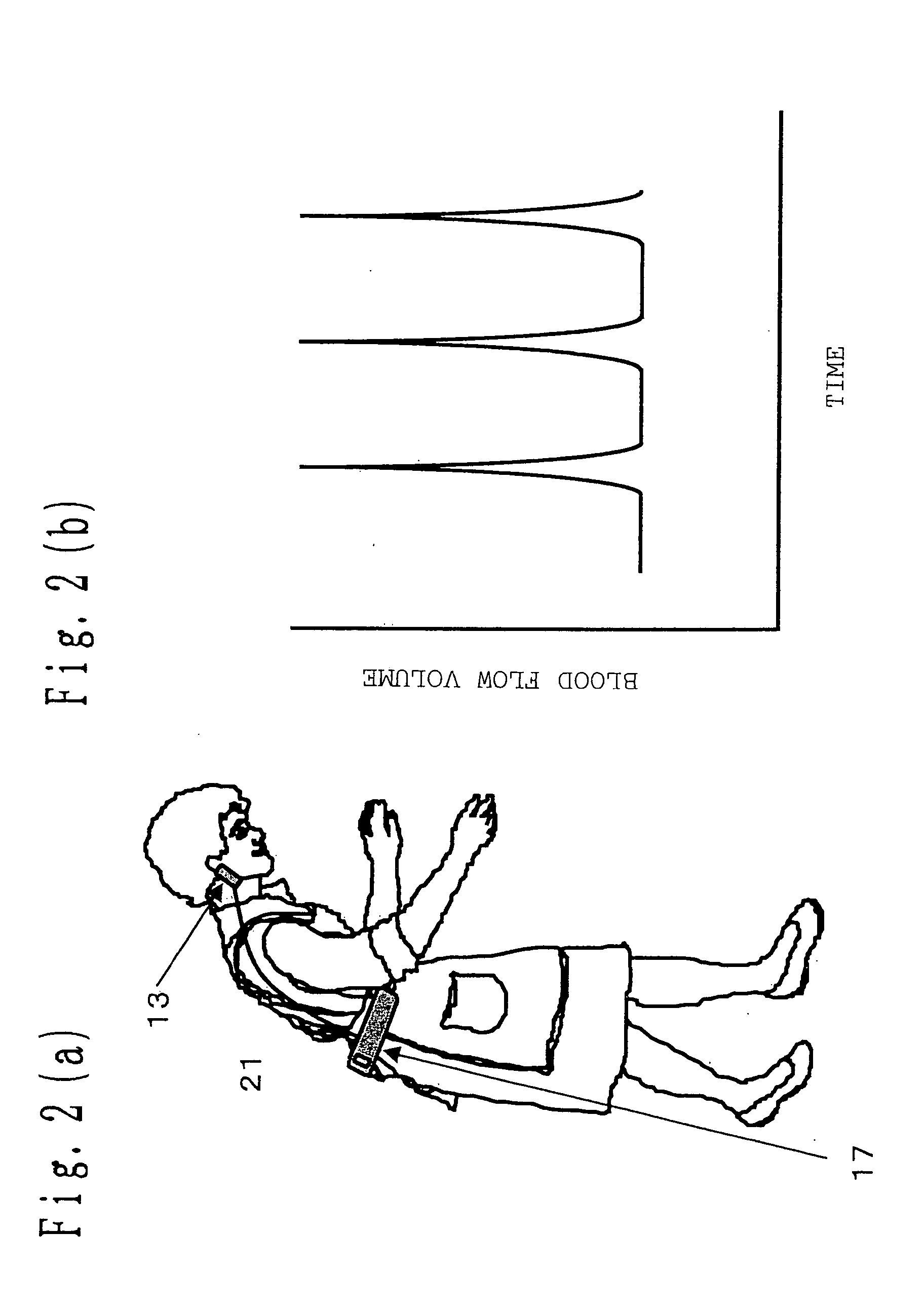 Pulse abnormality monitor and pulse abnormality warning system