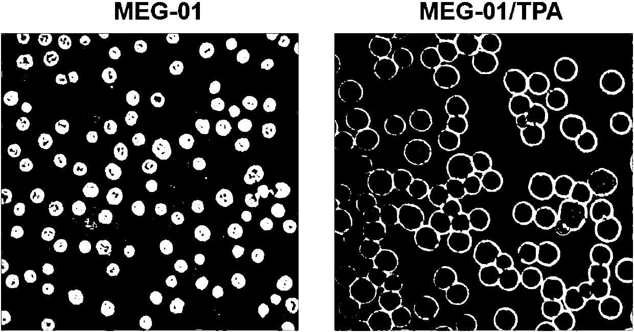 miRNA regulated and controlled blood platelet Gelsolin and application thereof to screening antiplatelet medicines