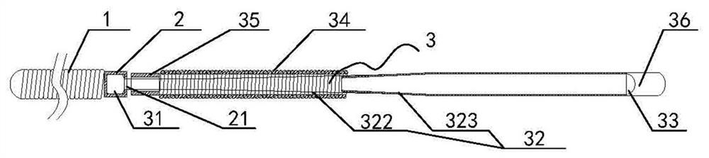 A spring coil conveying release system