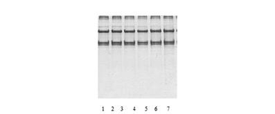 Method for preparing lysosomal collagen