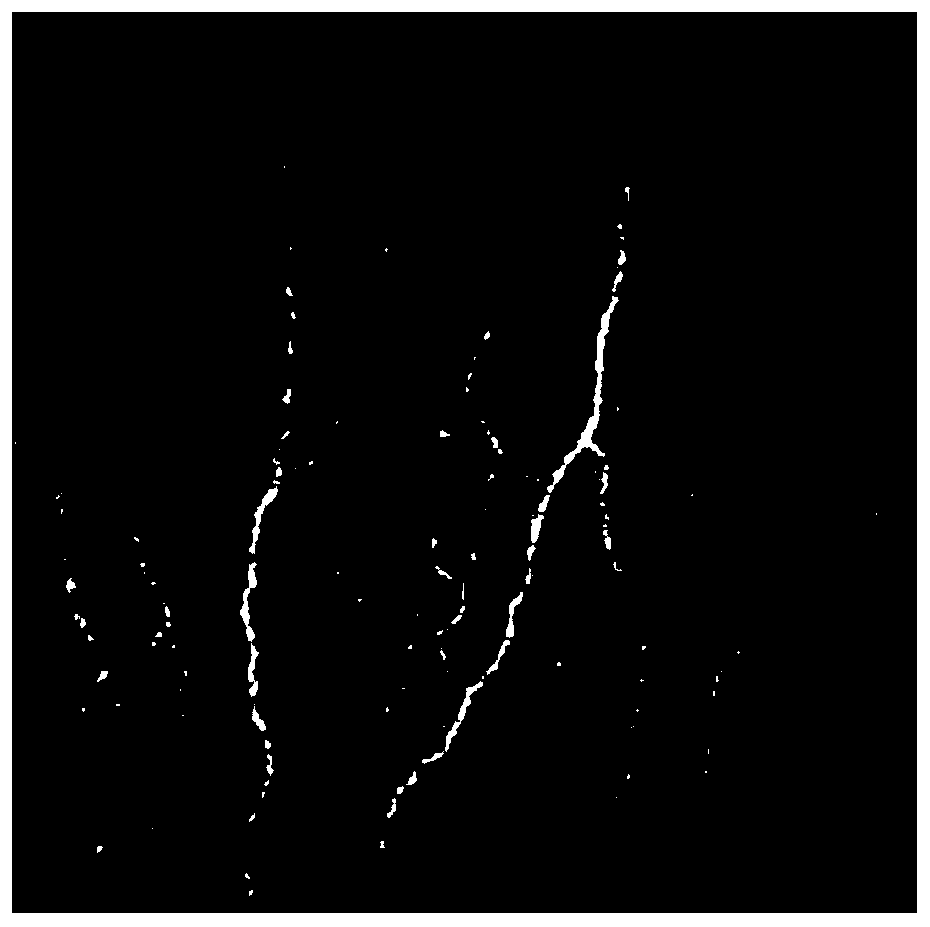 Convolutional neural network-based fungal keratitis detection method and system