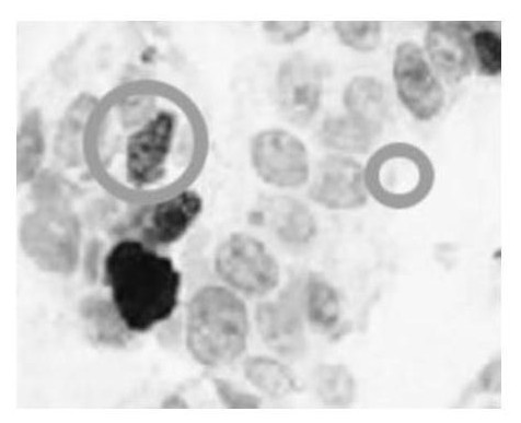 Cell nucleus segmentation and counting method and system for immunohistochemical cell images