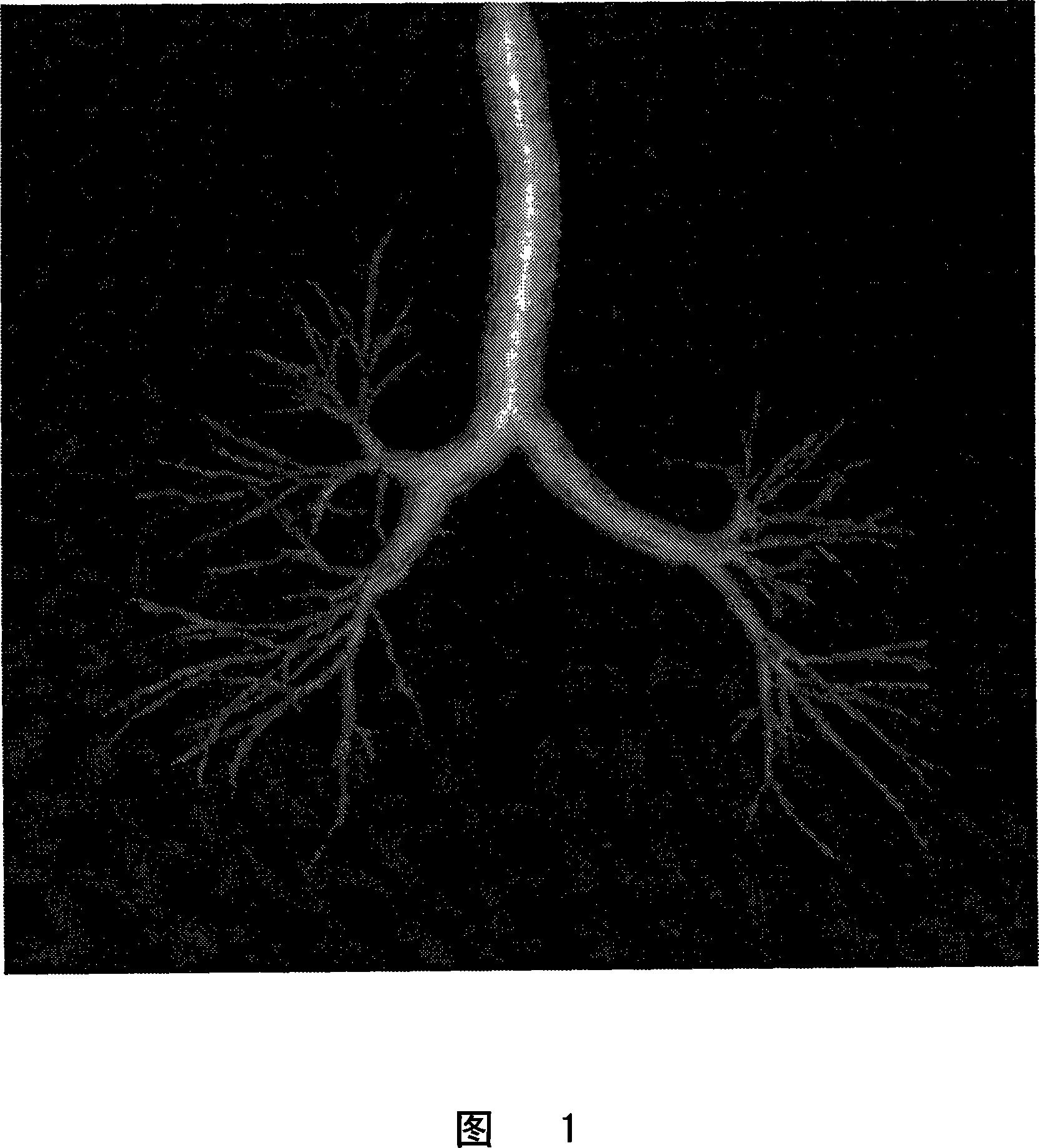 Planar angular visualization of the bronchial tree