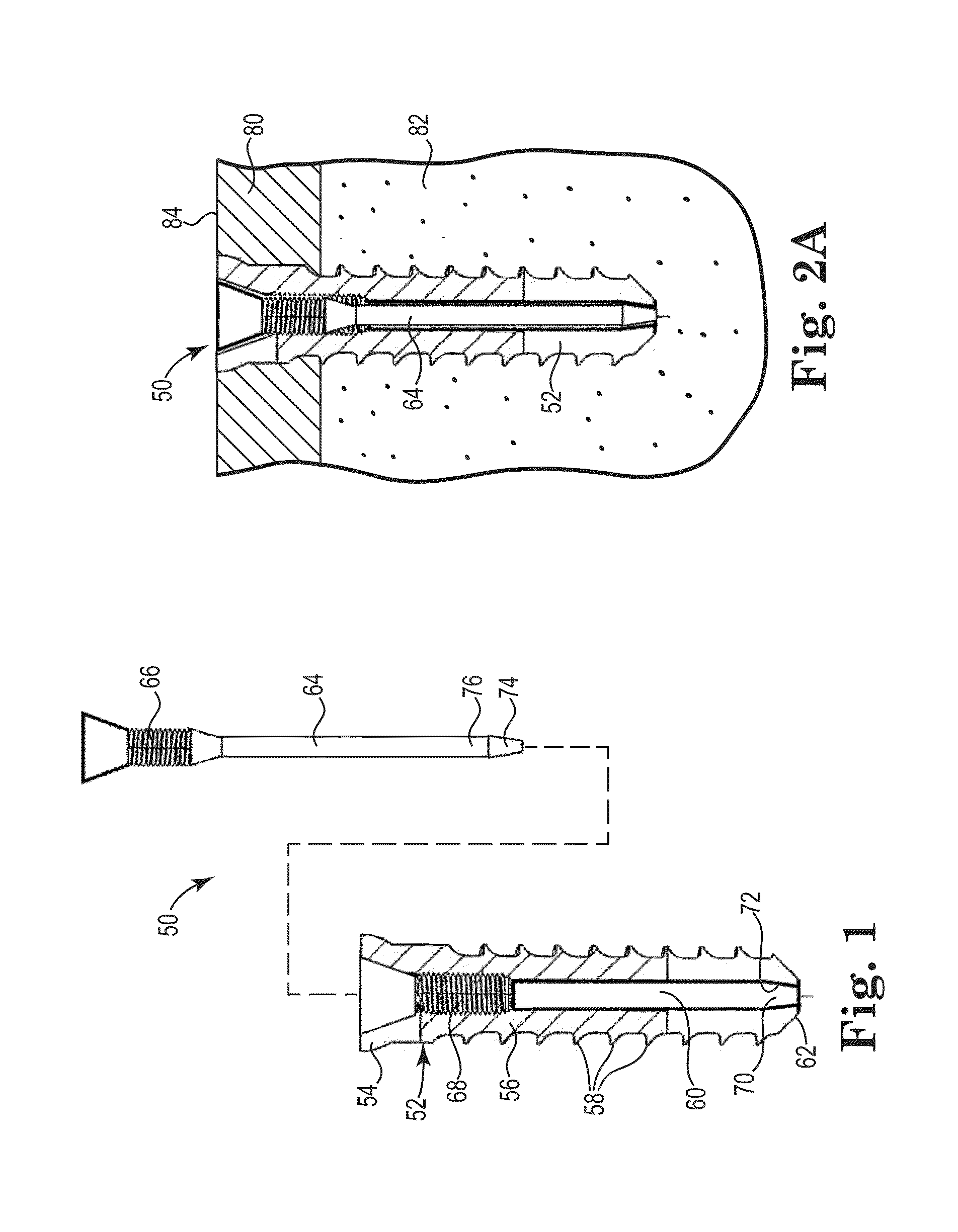 Fixation system for orthopedic devices