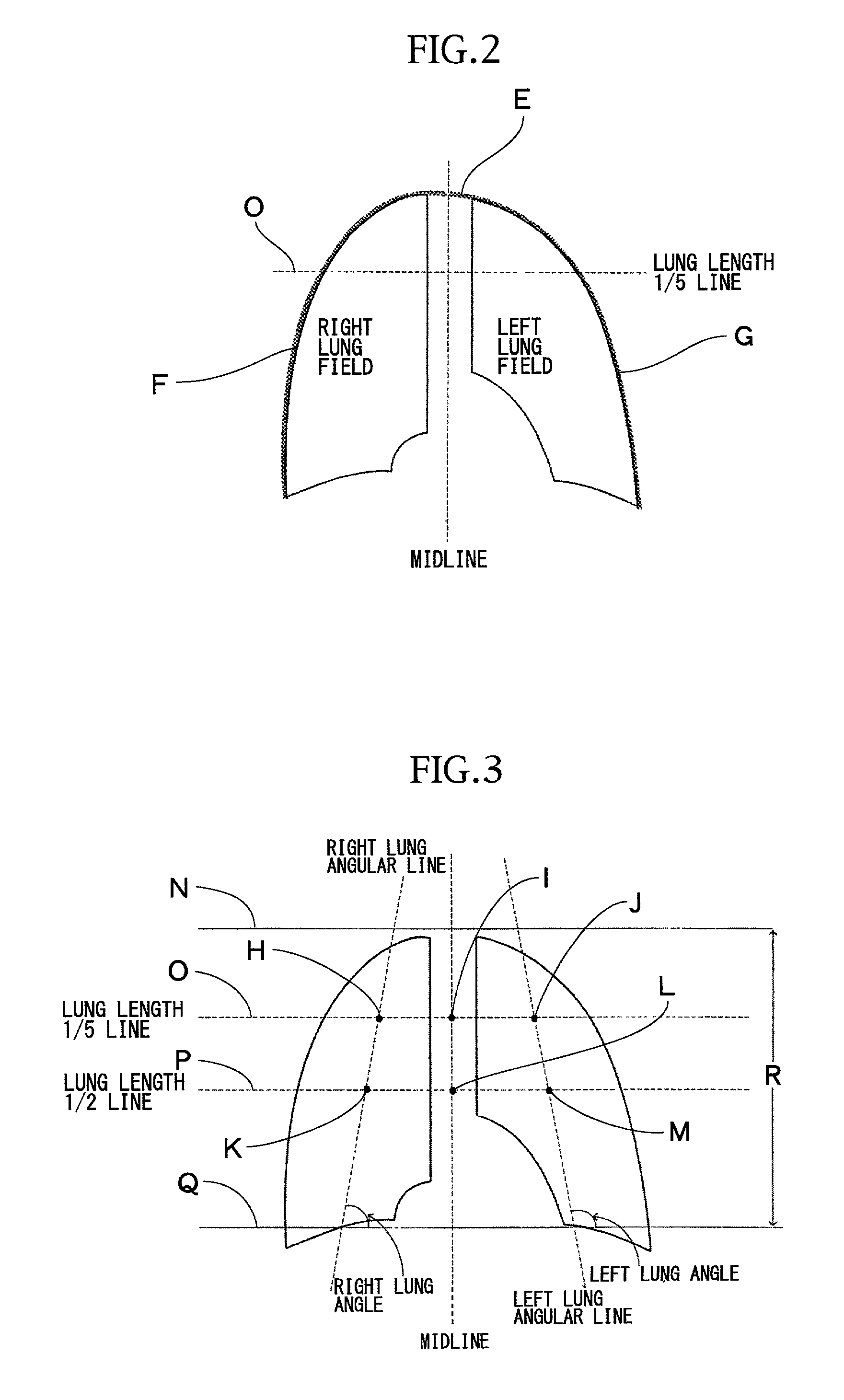 Detection of ribcage boundary from digital chest image