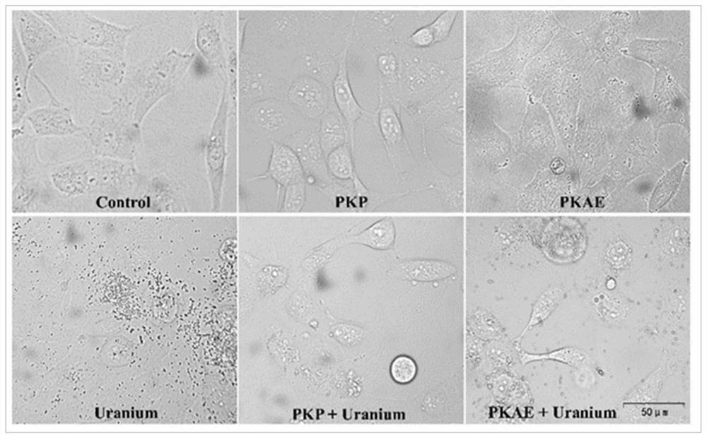 Application of rhizoma polygonati in preparation of medicine for preventing and treating low-dose or/and chronic uranium exposure