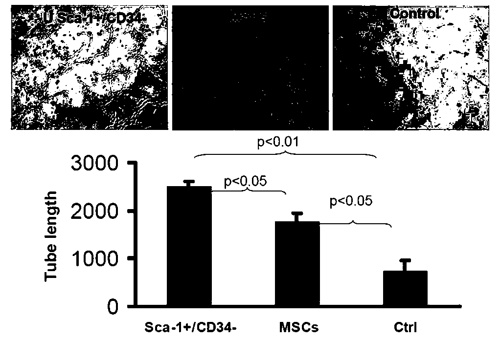 Sca-1+/CD34- uterine stem cells and separation method thereof