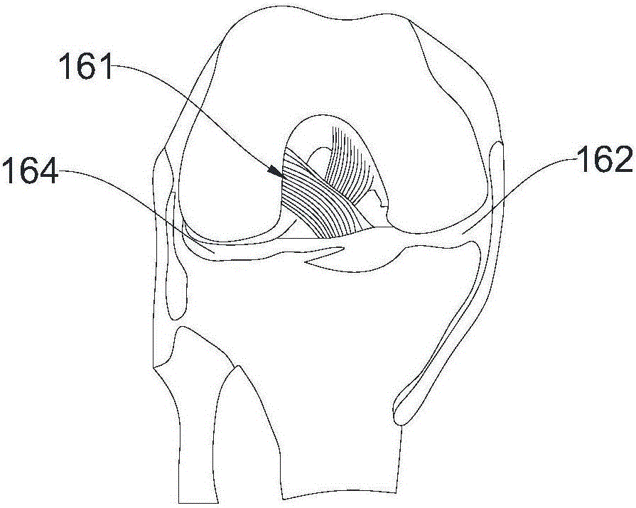 Bone tunnel expander and preparation method of detachable adapter of bone tunnel expander