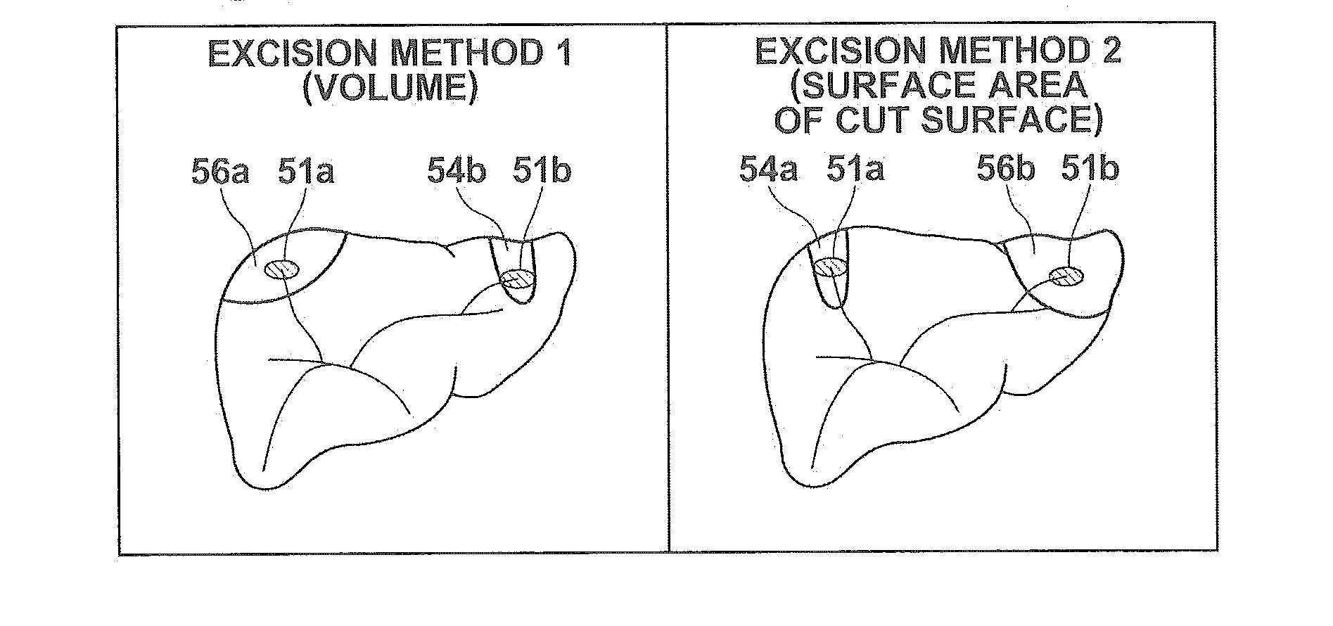 Surgery assistance apparatus, surgery assistance method and non-transitory computer-readable recording medium having stored therein surgery assistance program