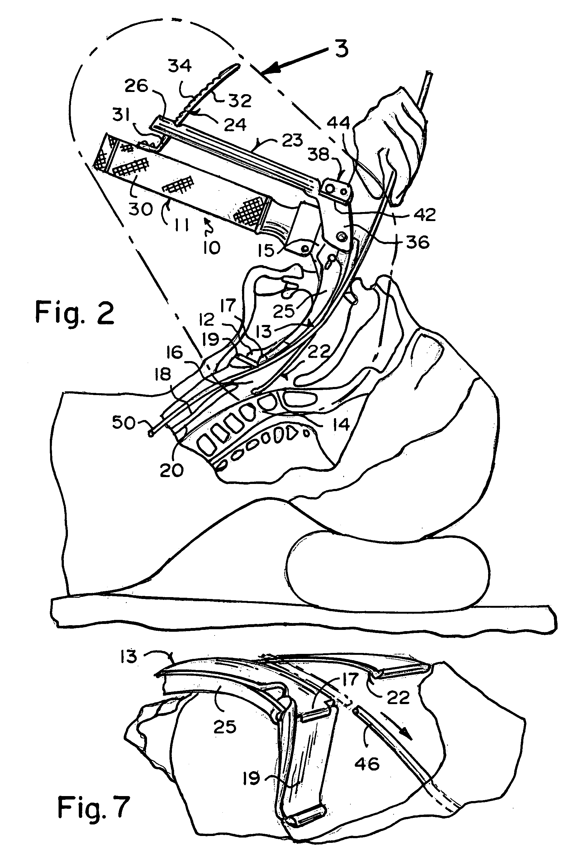 Laryngoscope for simultaneously facilitating the illuminating of a throat pathway and inserting an intubation tube