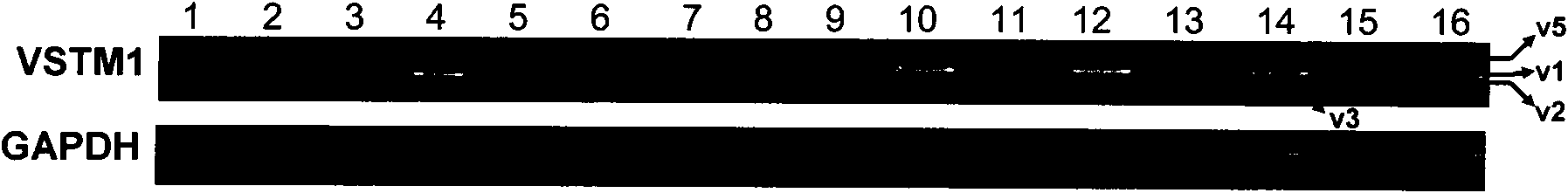 New human cell factor VSTM1-v2 and application thereof