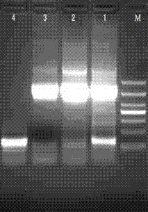 A kind of recombinant vaccinia virus vaccine for treating bovine brucellosis and preparation method thereof