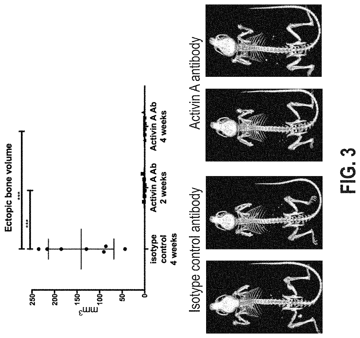 Genetically modified rodent with an inducible ACVR1 mutation in exon 7 that causes ectopic bone formation