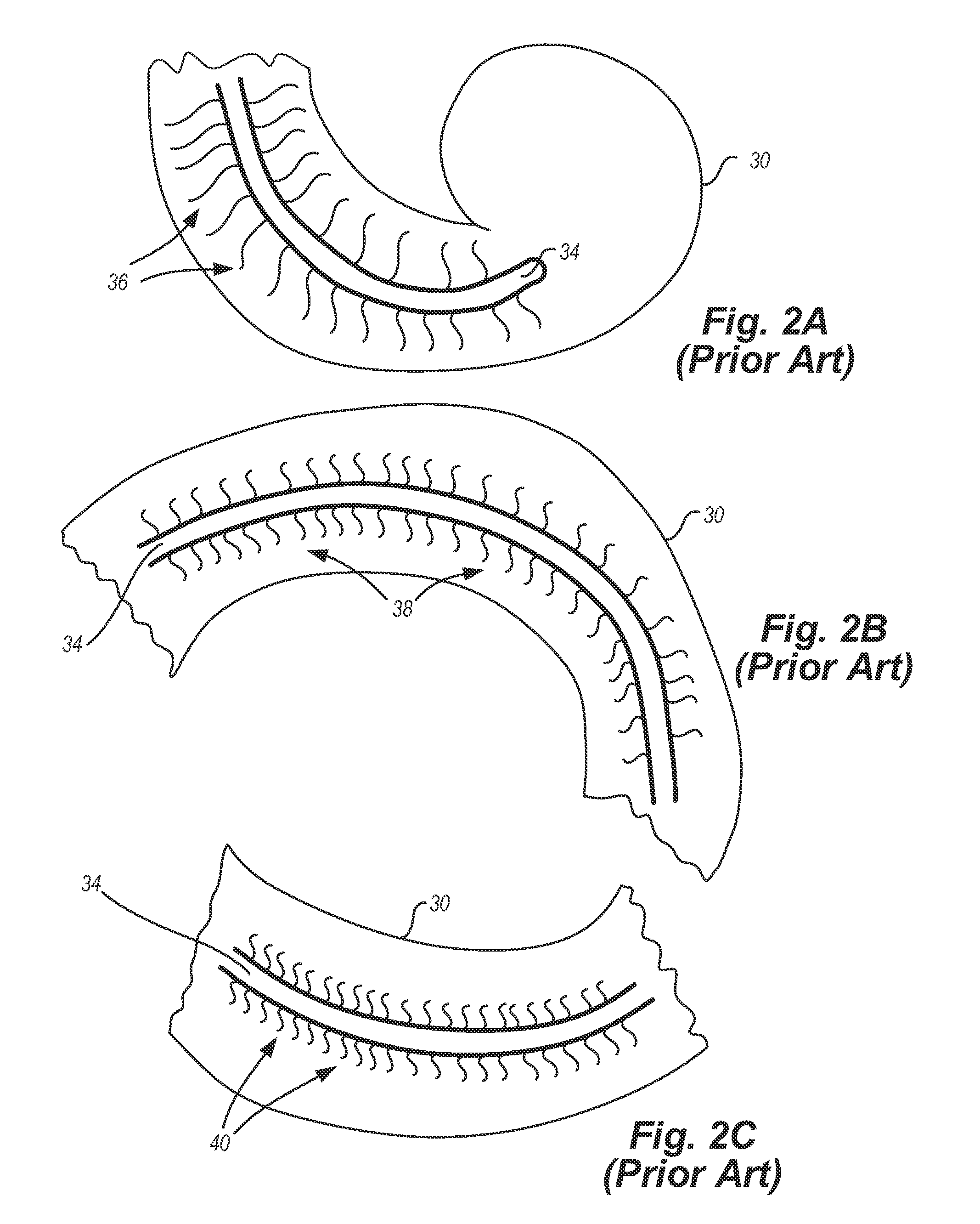 Localized therapeutic hypothermia system, device, and method