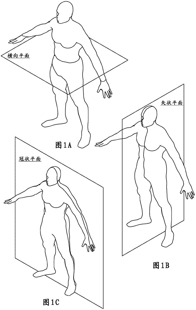 Thoracic aorta ventricular assist system