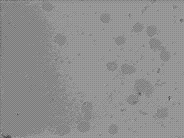 MRNA-level in-situ hybridization detection kit for KLOTHO gene in pancreas precancerous period of KLOTHO gene in prophase of pancreas cancer detecting method and application