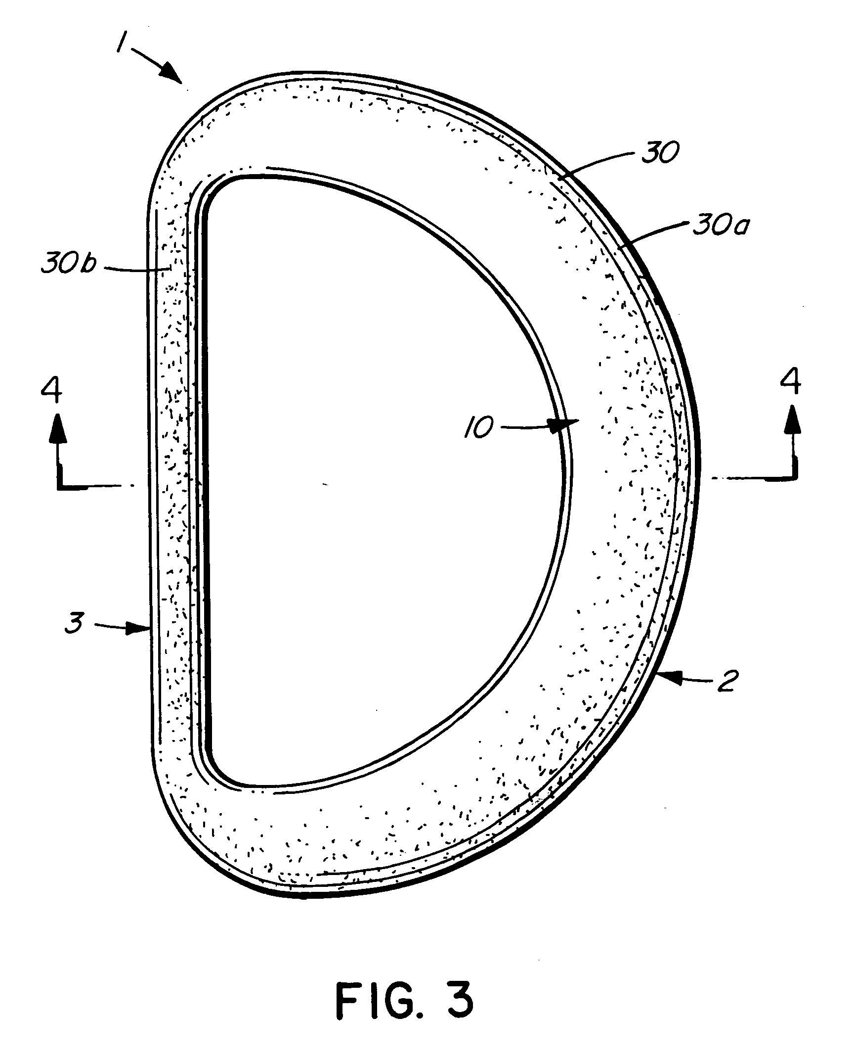 Valve prosthesis including a prosthetic leaflet