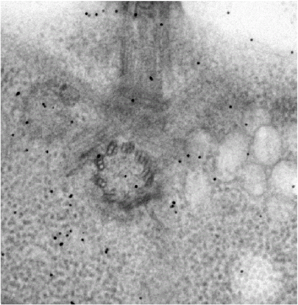 Diameter estimation and automatic identification methods for colloidal gold in electron tomography image