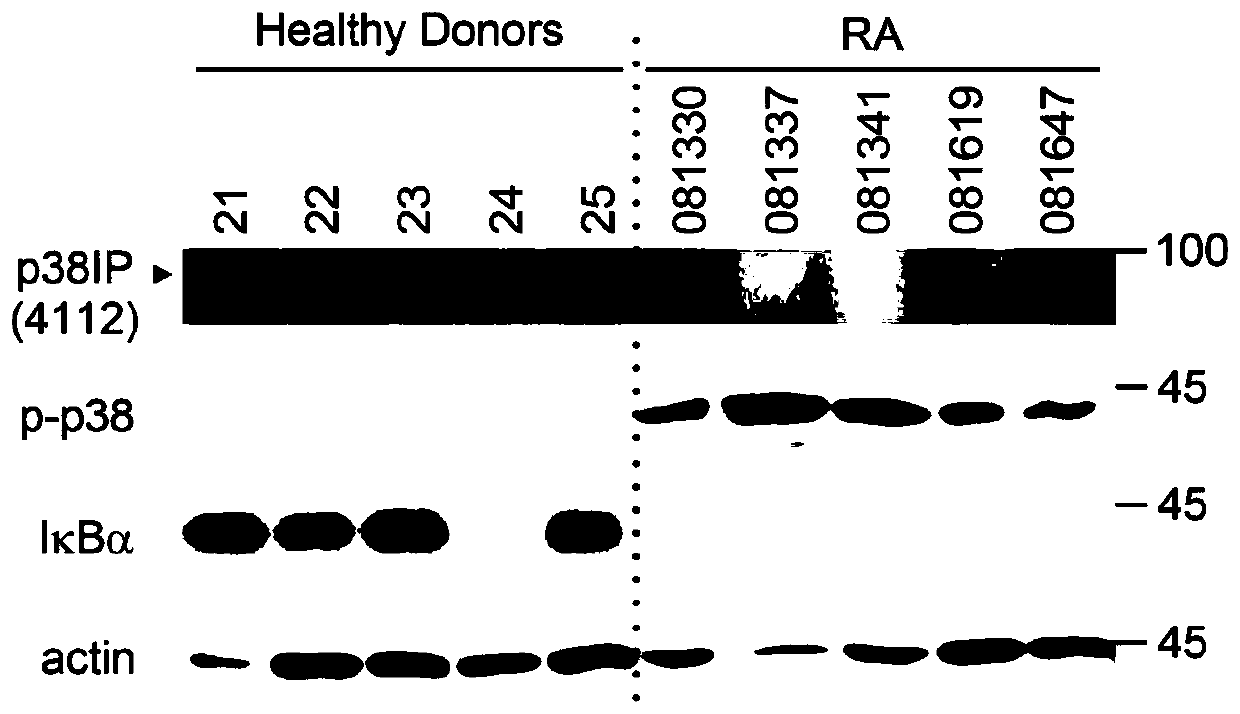 Rheumatoid arthritis diagnostic marker and application thereof