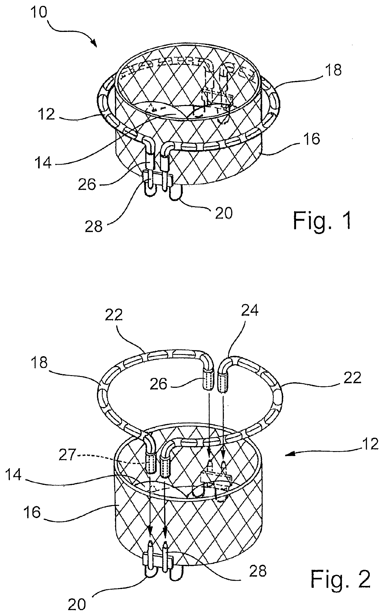 Device for arranging guidewires around a heart valve