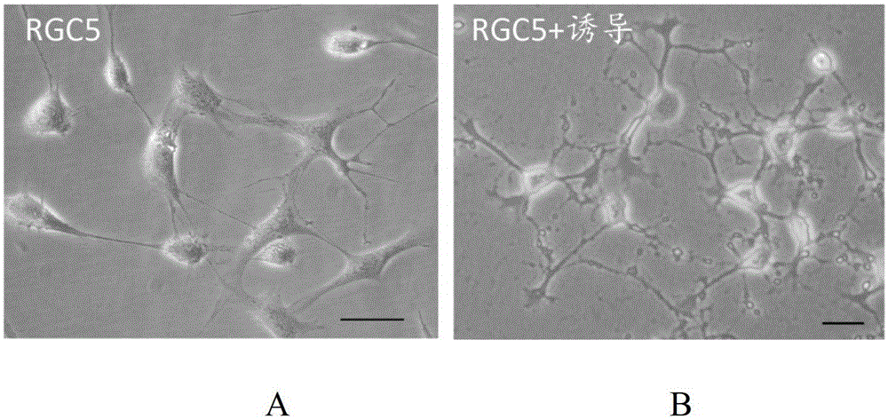 A type Ⅱ adeno-associated virus carrying neuritin gene and its application in repairing optic nerve damage