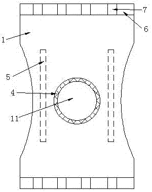 Adjustable kneecap