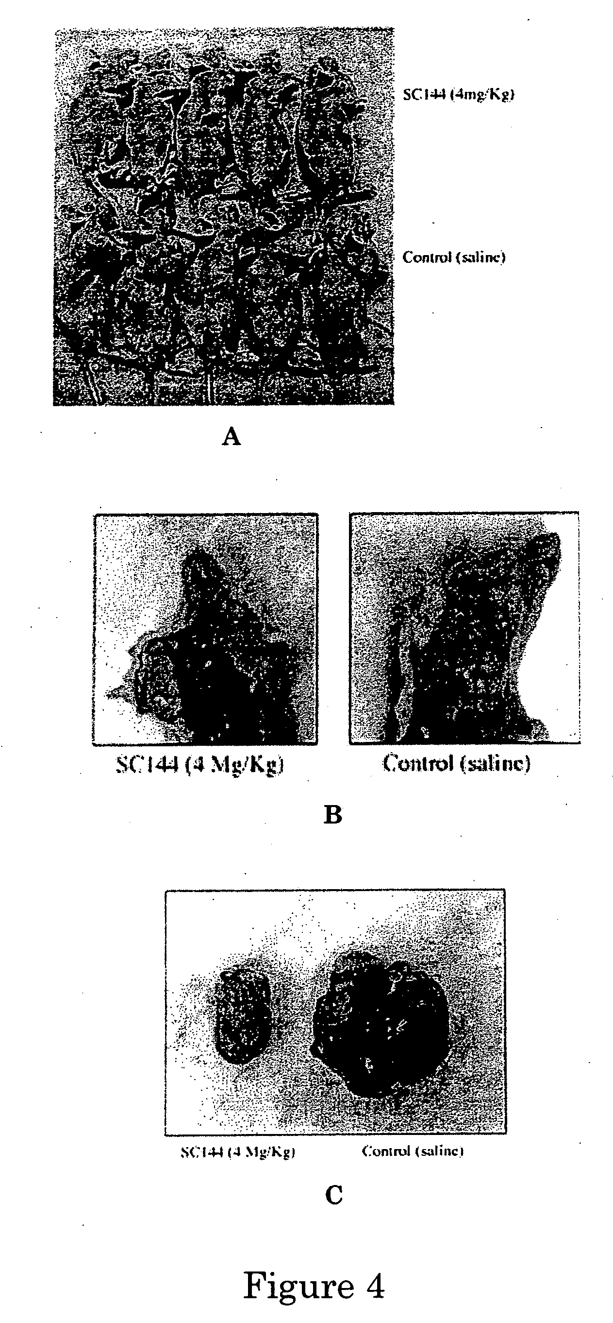 Novel compounds for treatment of cancer and disorders associated with angiogenesis function