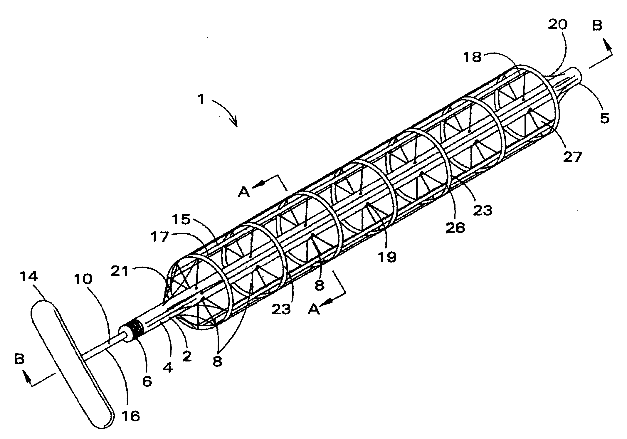 Mechanically deployable upper airway stent