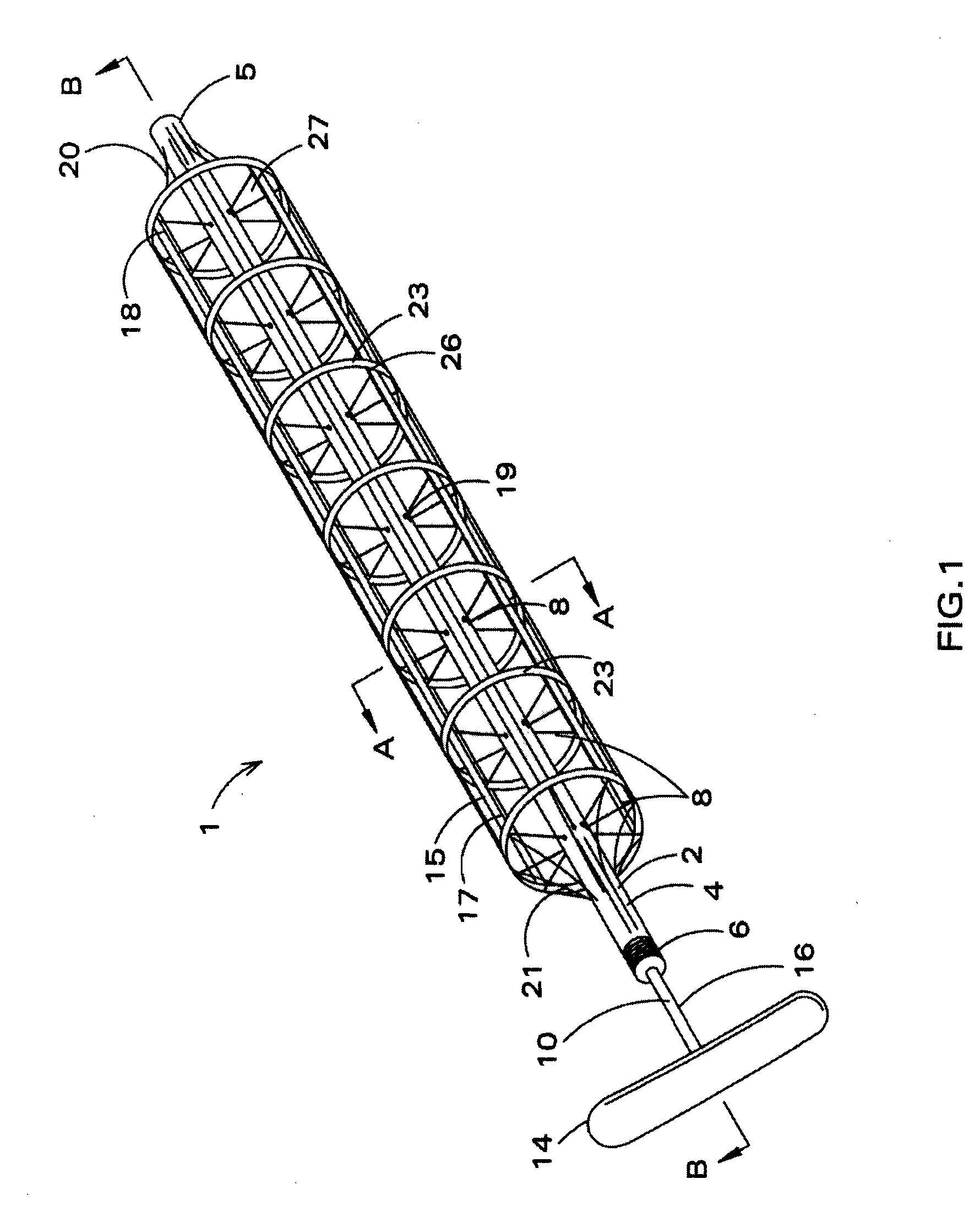 Mechanically deployable upper airway stent