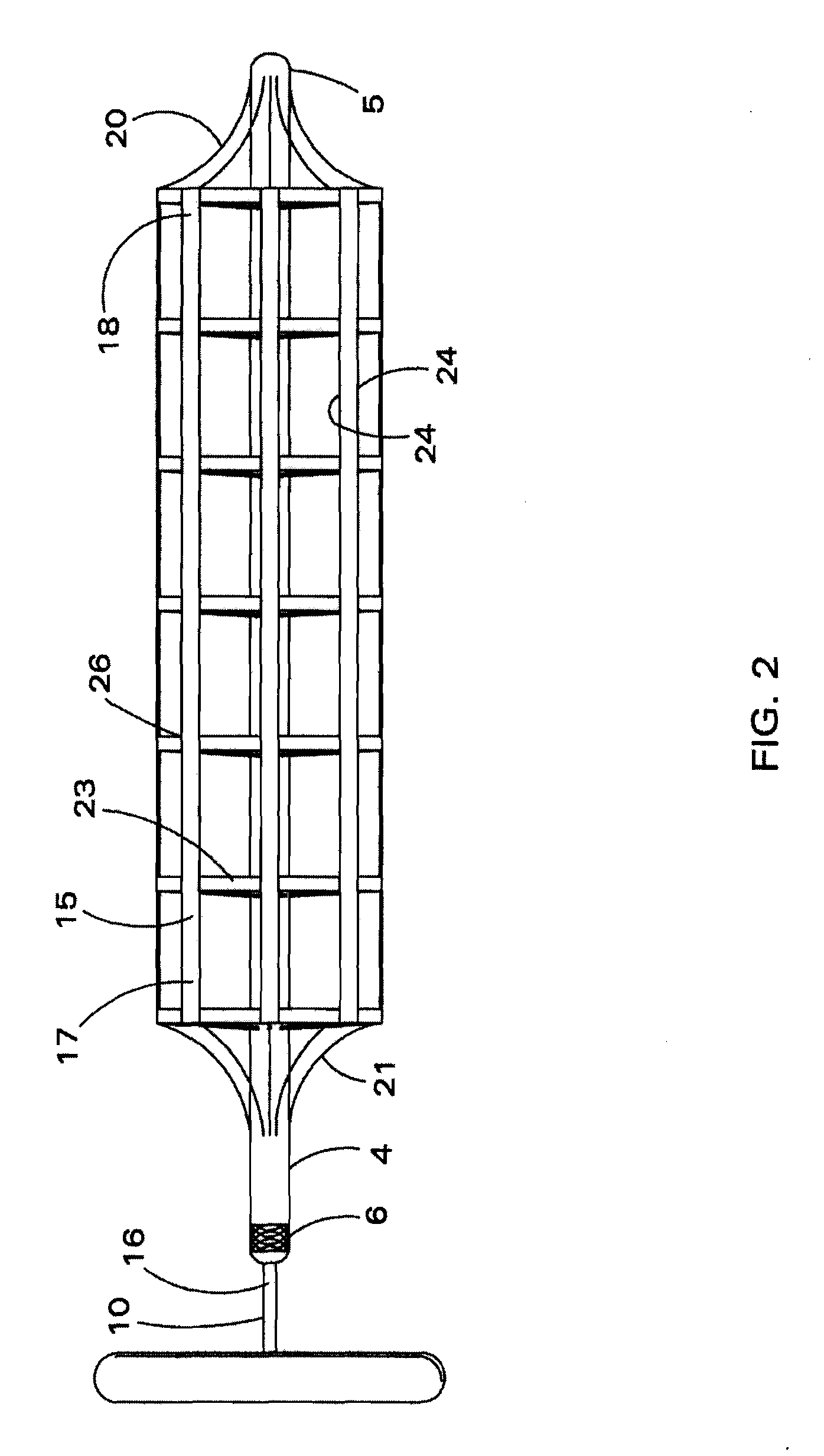 Mechanically deployable upper airway stent