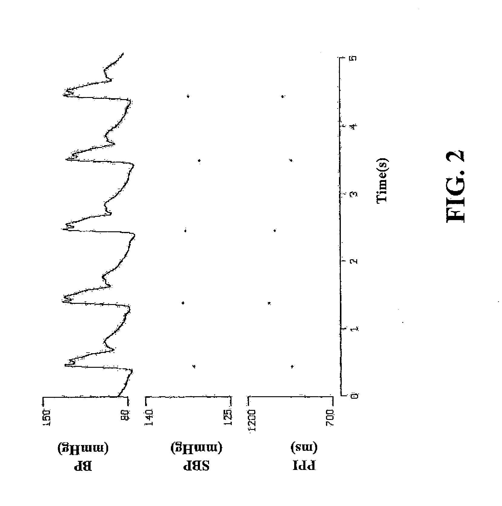 Analysis system and a method for pulse diagnosis in chinese medicine