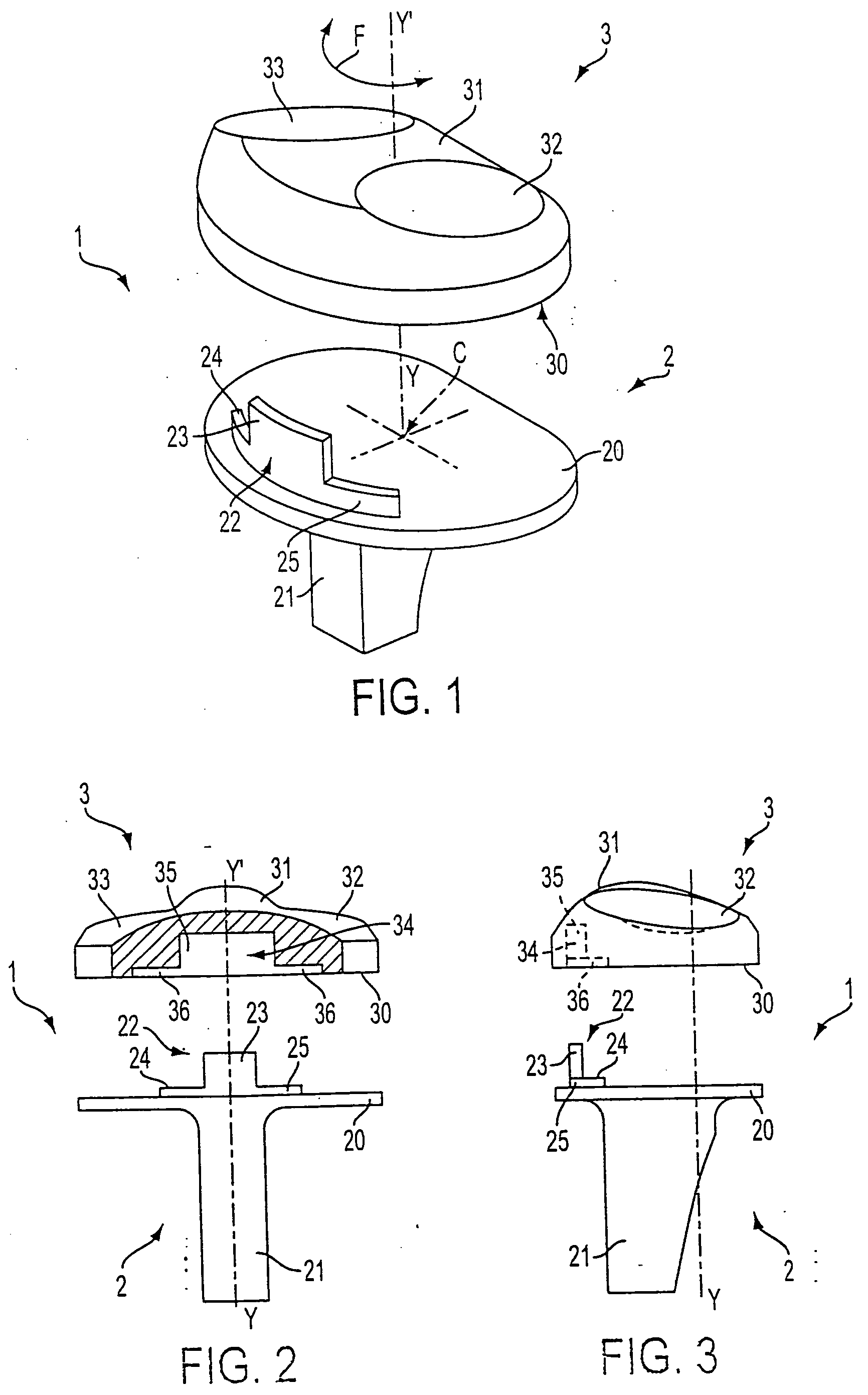 Knee prosthesis with a rotational plate