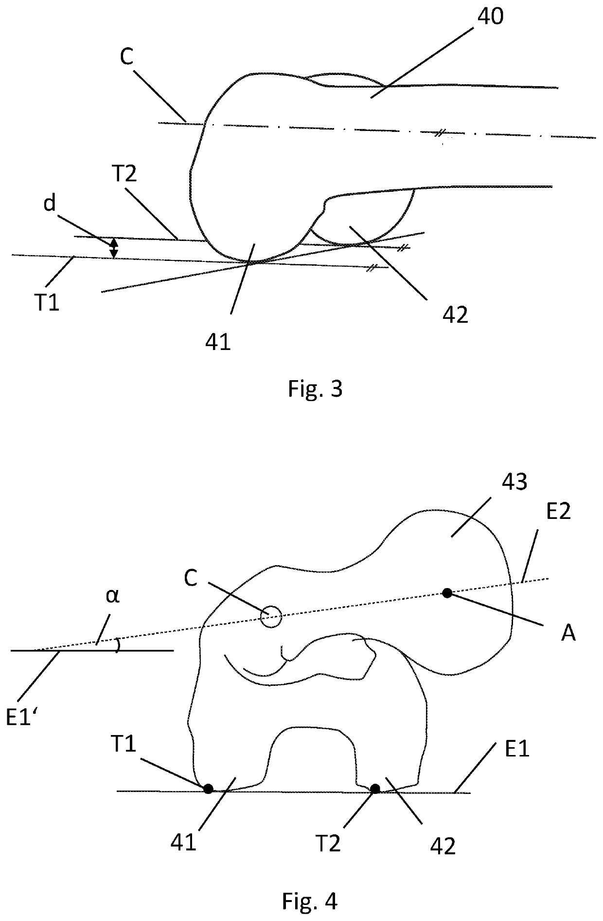 Device for determining the anteversion angle