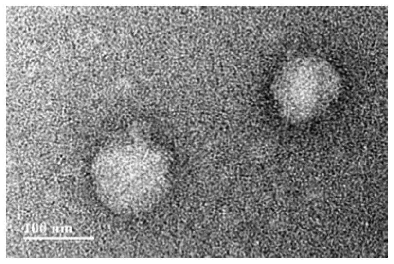 Targeted oxygen-carrying nano sonosensitizer and preparation method thereof