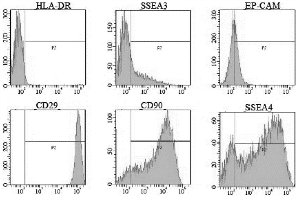 Screening and identifying method and application of amniotic stem cell exocrine protein