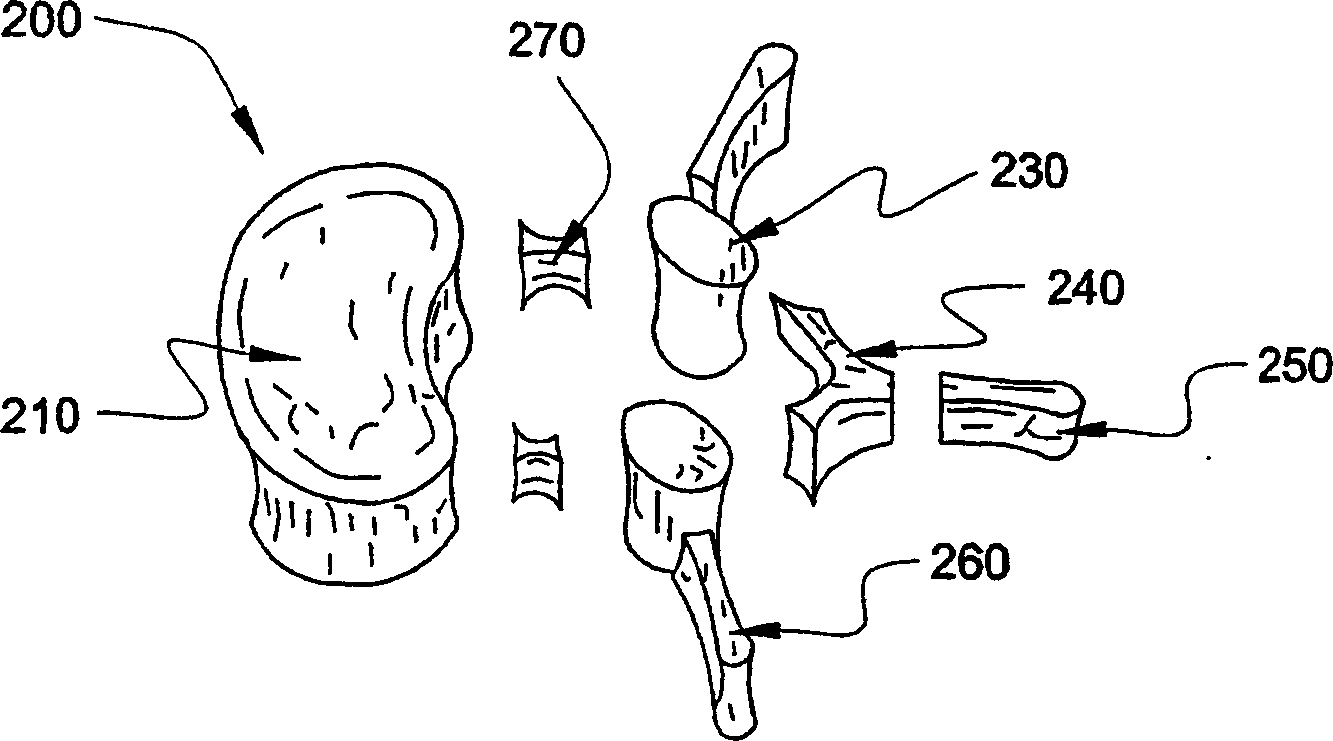 Laminoplasty devices and methods