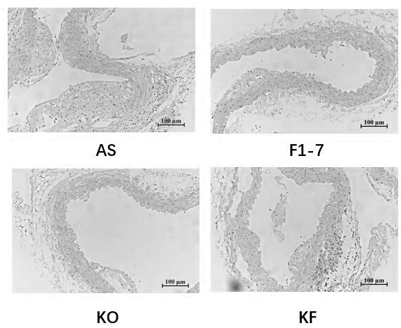 Preparation method and application of animal bifidobacterium F1-7 and euphausia superba oil composition for improving atherosclerosis inflammation