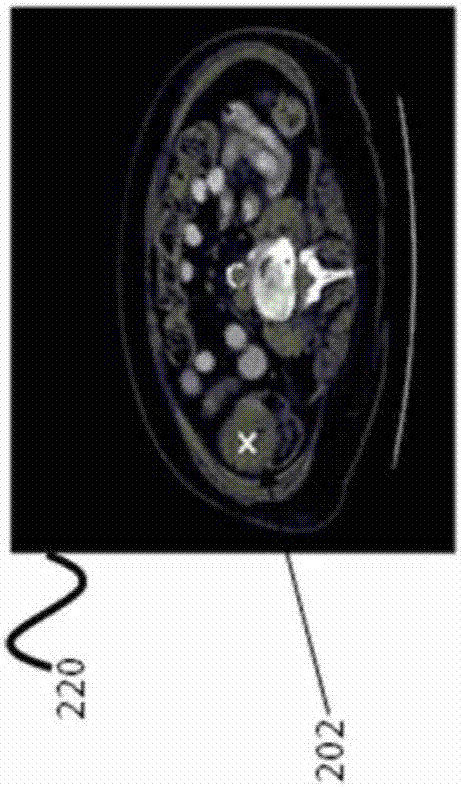 Automatic region-of-interest segmentation and registration of dynamic contrast-enhanced images of colorectal tumors