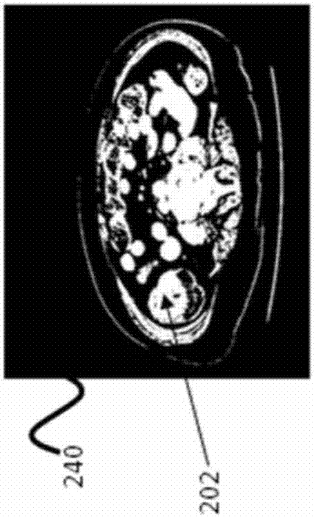 Automatic region-of-interest segmentation and registration of dynamic contrast-enhanced images of colorectal tumors