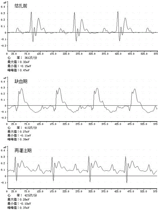 O-nitro caffeic acid phenethyl ester, preparation method and application thereof