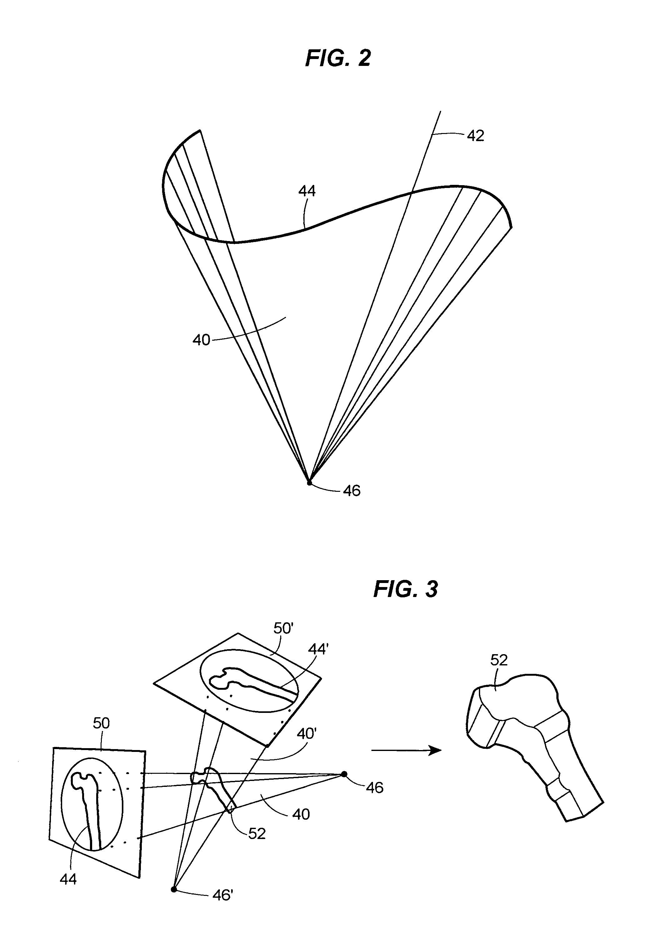 Method for navigating in the interior of the body using three-dimensionally visualized structures