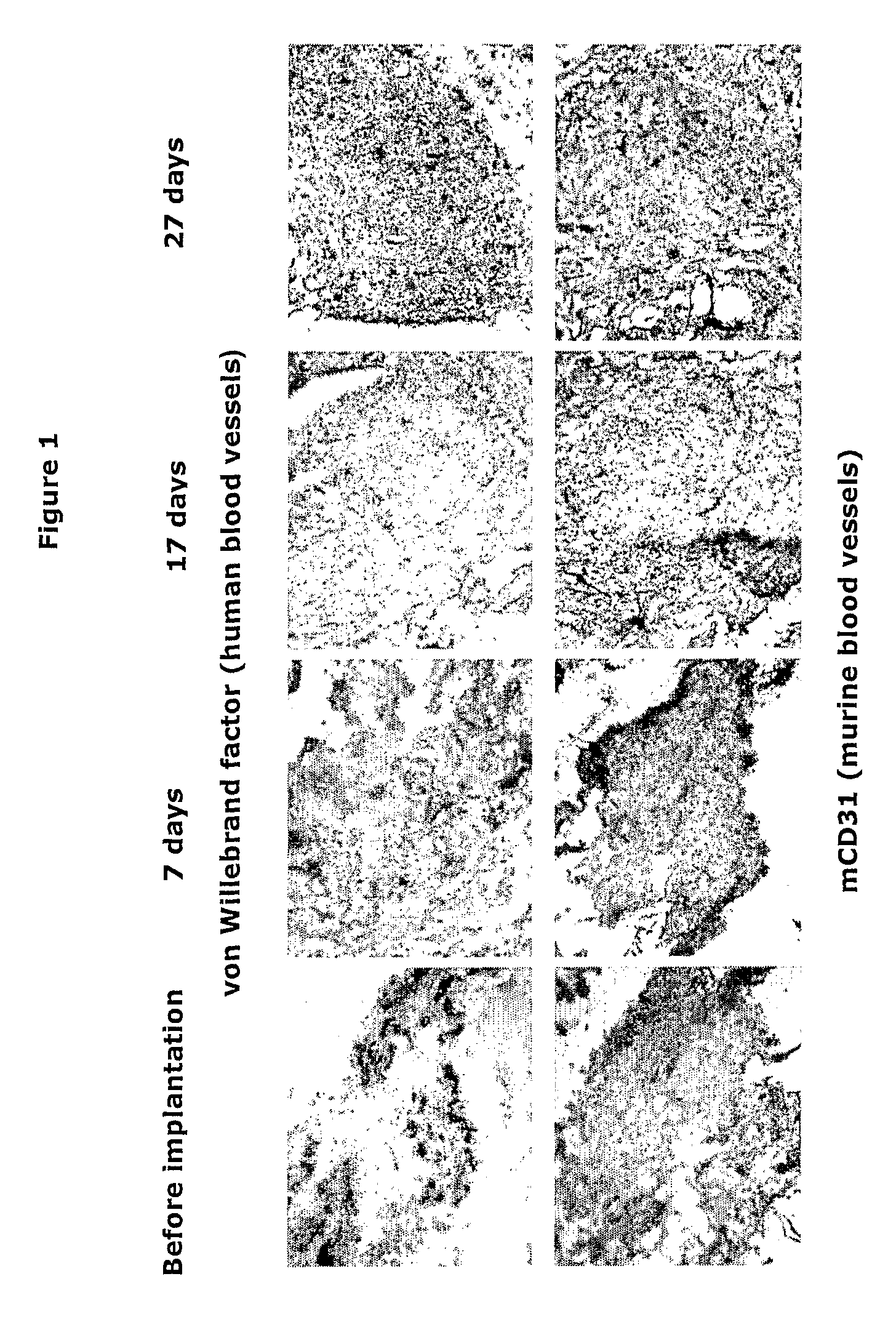 Non-Human mammalian Arthritis Model Featuring Human Antibodies Against Citrul-Linated Proteins