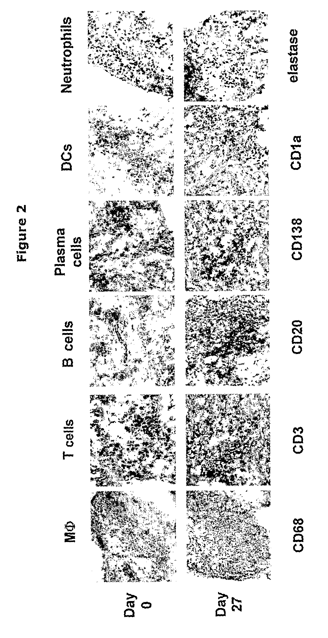 Non-Human mammalian Arthritis Model Featuring Human Antibodies Against Citrul-Linated Proteins